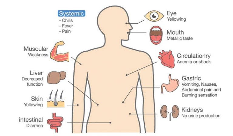 Is Your Body Full of Toxic Metals? Here Are The Signs to Watch For!