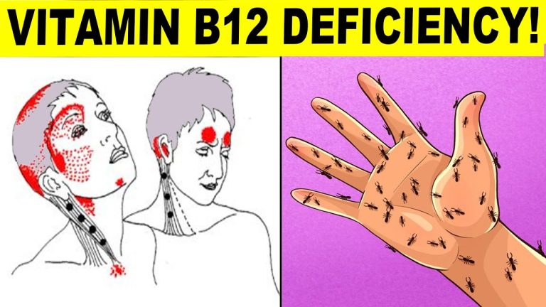 Signs of Vitamin B12 Deficiency You Should Never Ignore