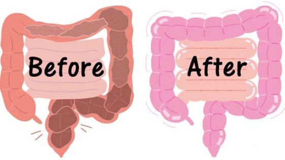 This Is The Best Natural Laxative And You Will Lose 3 Kg In 1 Day!