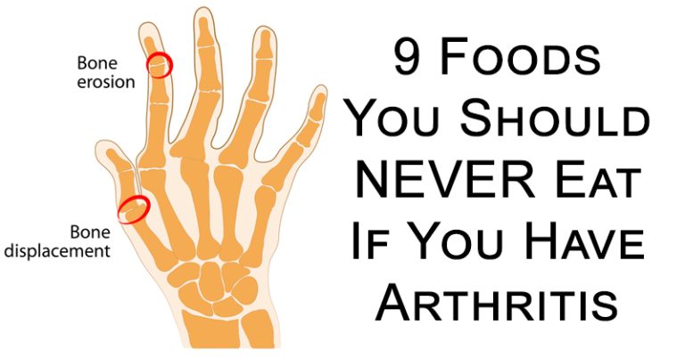 9 Foods You Should Never Eat If You Have Arthritis