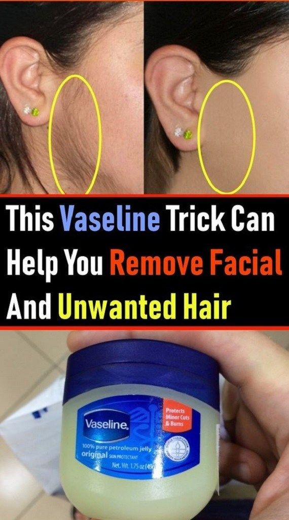 This Vaseline Trick Can Help You Remove Unwanted Hair