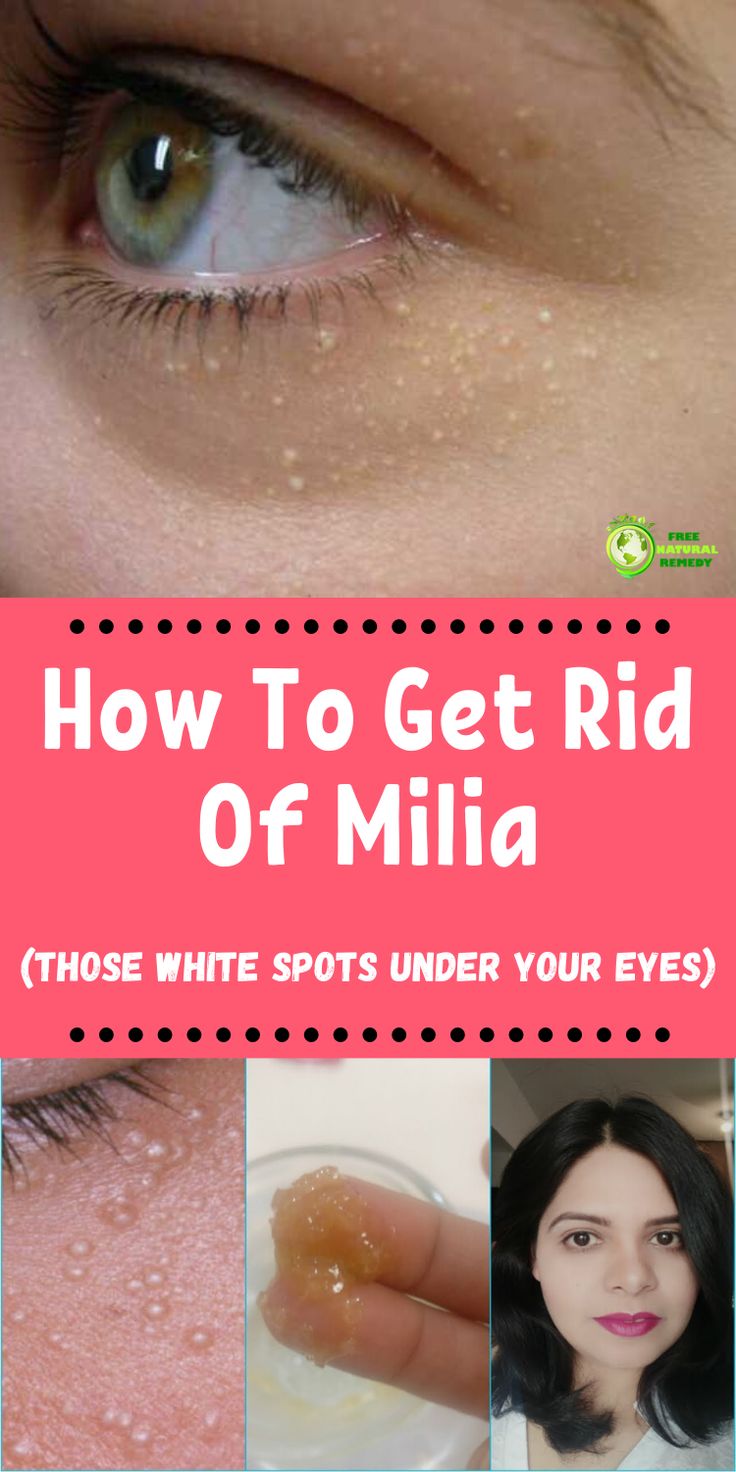 A Homemade Face Mask That Tightens The Skin Better Than Botox