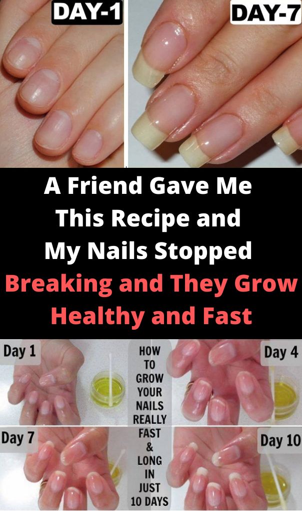 A Friend Gave Me This Recipe And My Nails Stopped Breaking And They Grow Healthy And Fast