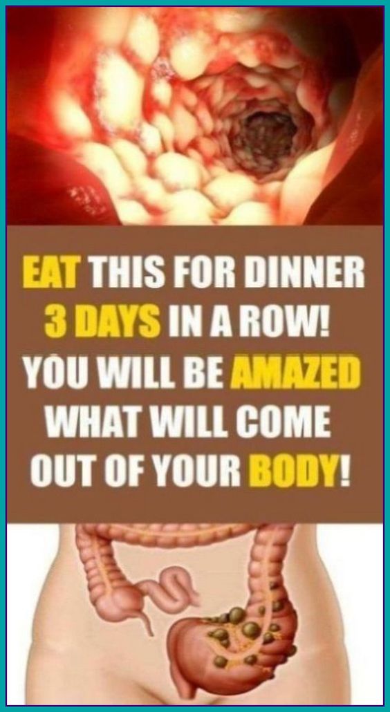 EAT THIS FOR DINNER 3 DAYS IN A ROW! YOU WILL BE AMAZED WHAT WILL COME OUT OF YOUR BODY!