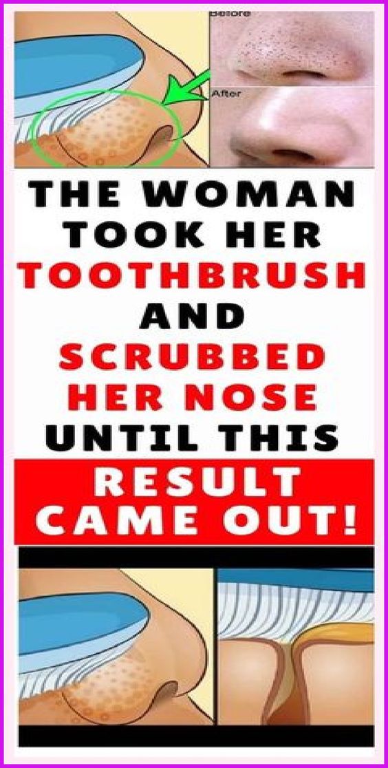 The Woman Took Her Toothbrush And Scrubbed Her Nose Until This Result Came out