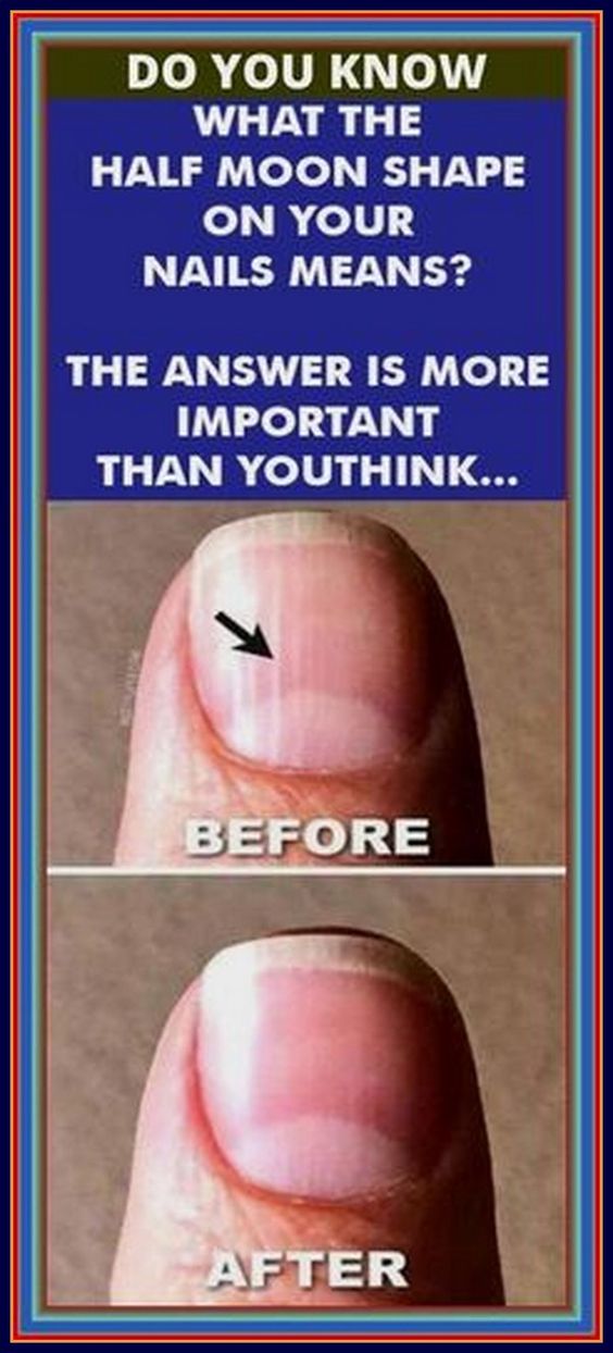 Do You Know What The Half Moon Shape On Your Nails Means The Answer Is More Important Than You Think