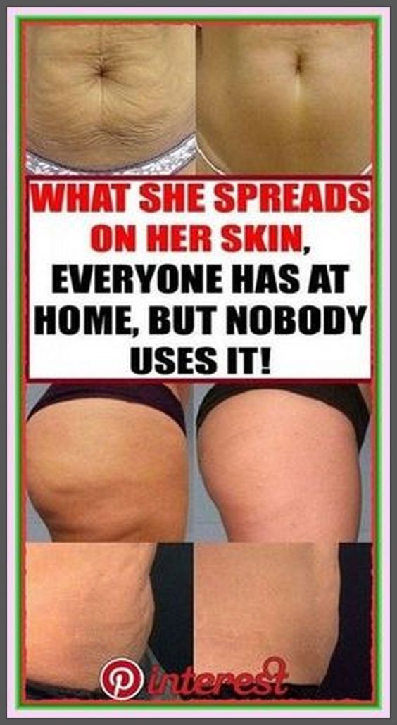 What She Spreads on Her Skin is in Every Home – But Almost No One Uses It Like This!