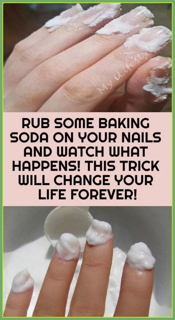 Rub Some Baking Soda On Your Nails And Watch What Happens?